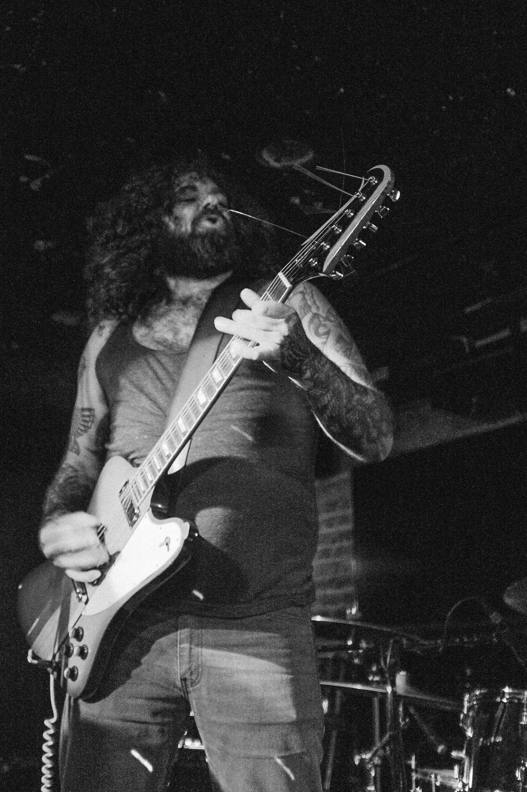 Birth Defects at Los Globos